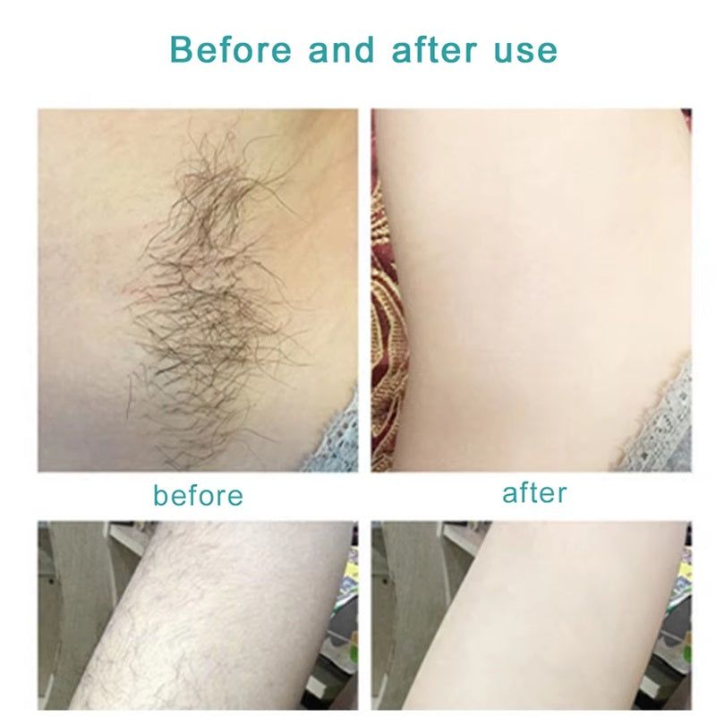 Before and after images showing effective results of the full body laser hair remover on underarm hair